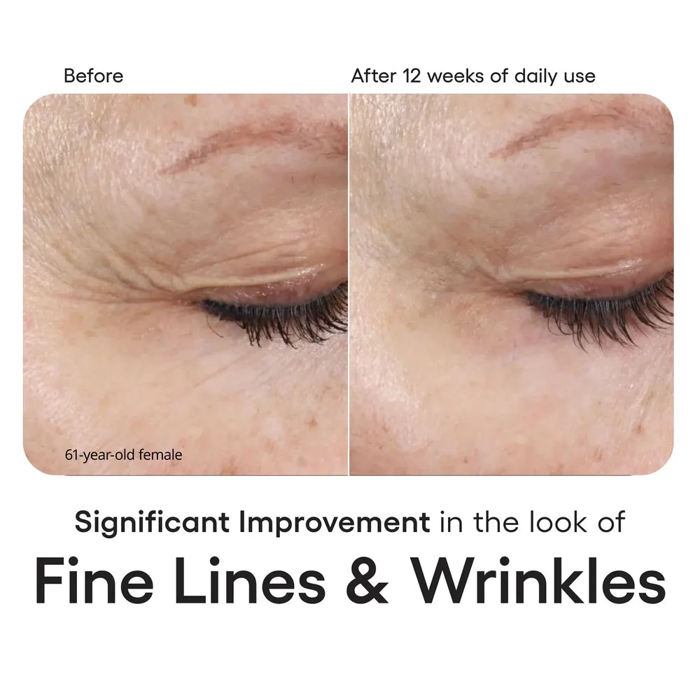 INTENSE serum Refill