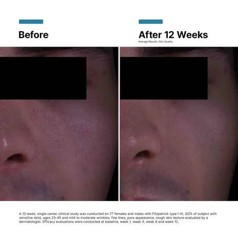 P-TIOX ANTI-WRINKLE CREAM